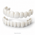 Design illustration of custom upper and lower veneers; not a photograph of the supplied product