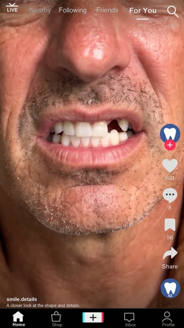 Smile set demo 02